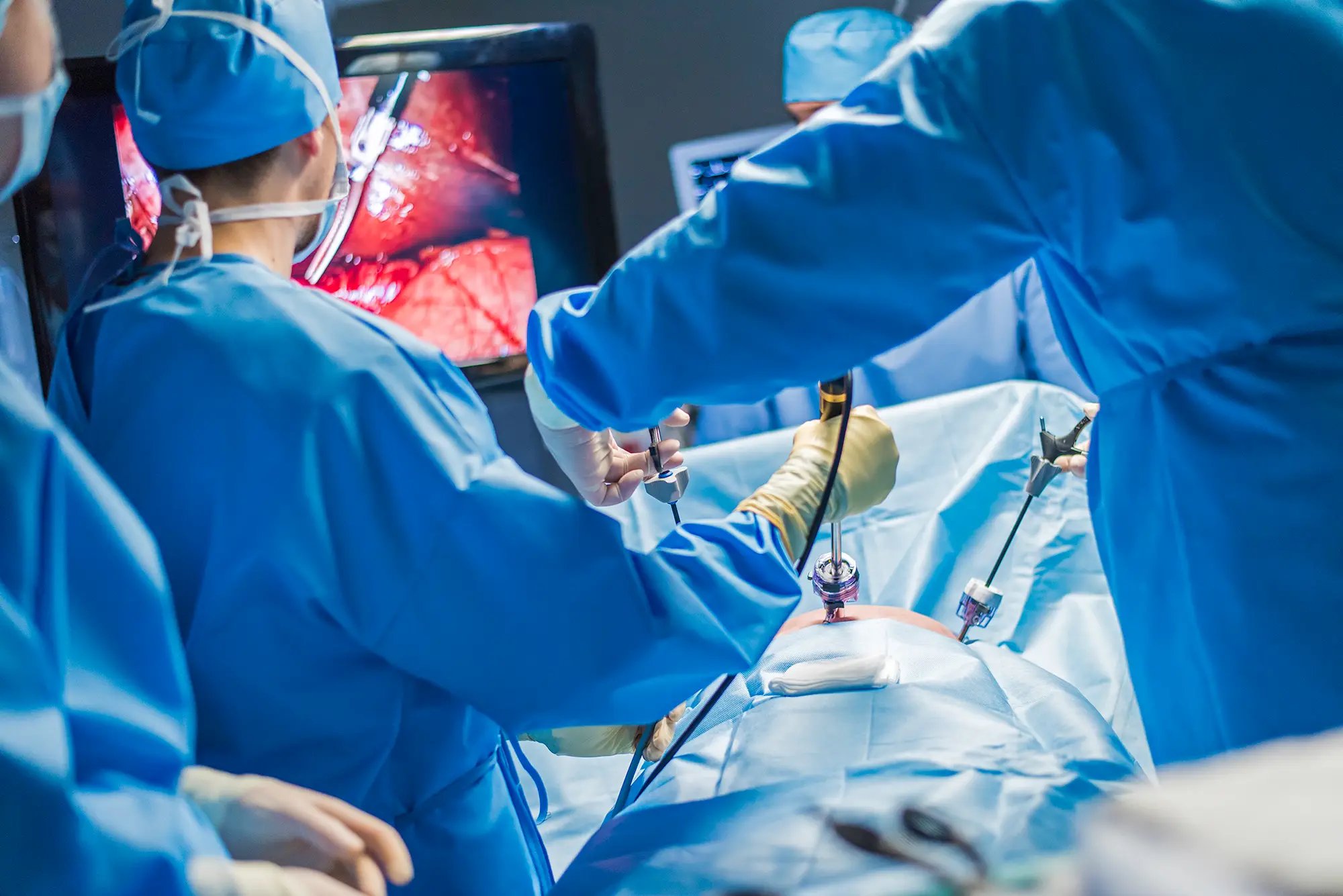 Precision Minimally Invasive Surgical Instrument Manufacturing